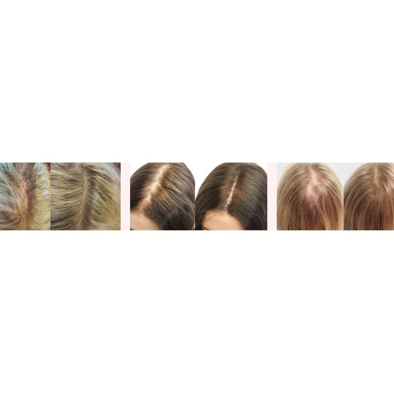 Scalp Serum Manufacturer - OEM Hair Growth Serum for Men Private