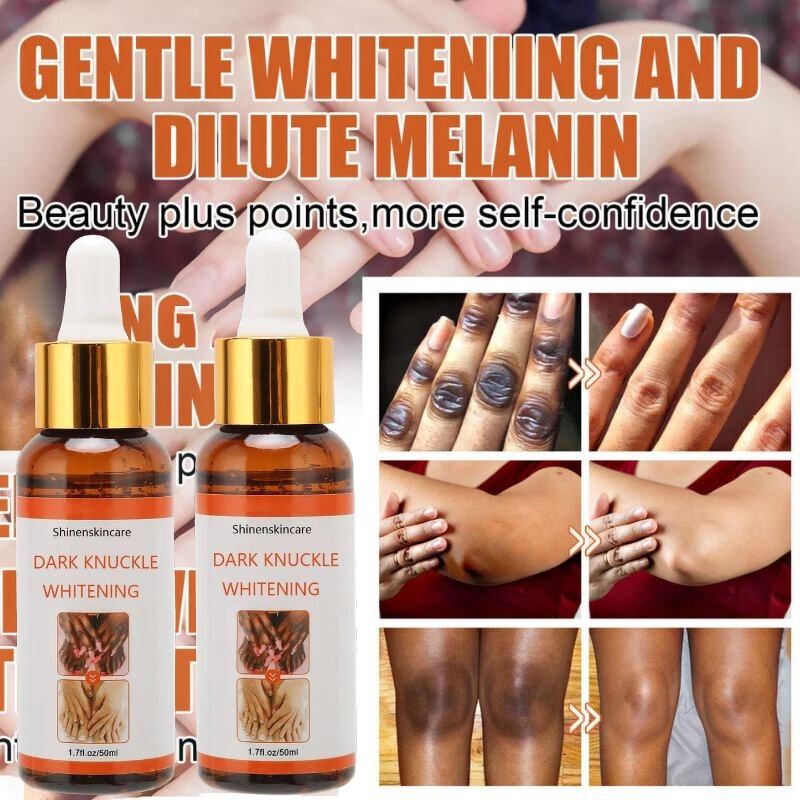 Hand Whitening Serum Supplier - OEM Private Label OEM ODM Hand