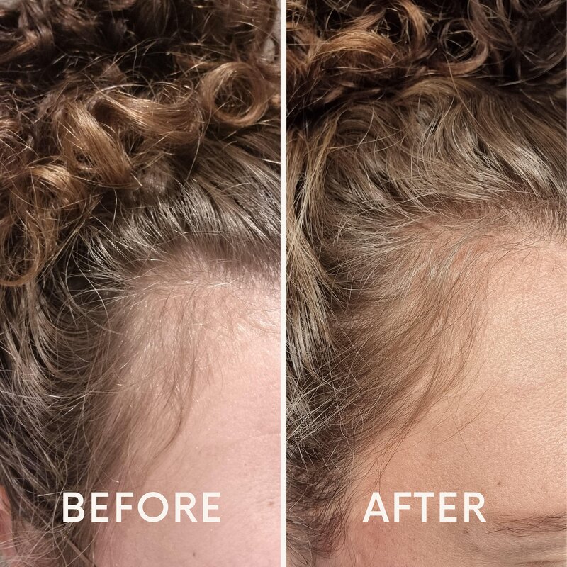 Biotin Hair Growth Serum Supplier - OEM Private Label Biotin Hair Growth