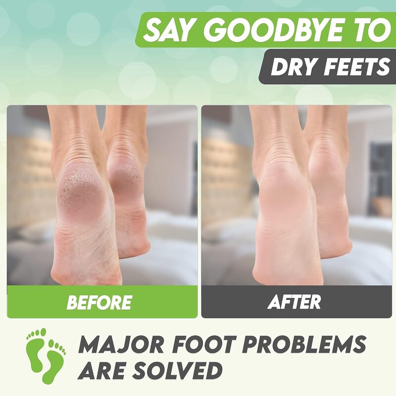 Peel Foot Mask Factory - OEM Green Tea Moisturizing Glycolic Acid