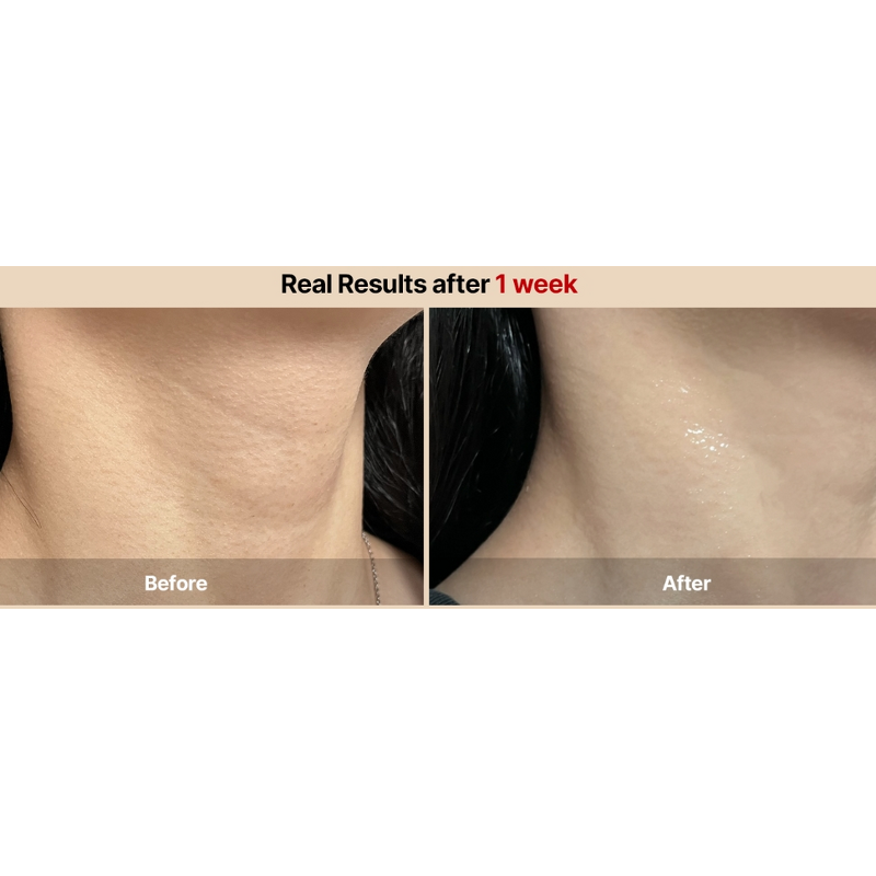 Chin-Up Lifting Neck Mask Factory - OEM Collagen Face Neck Jelly Mask