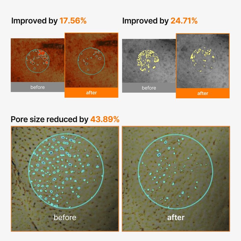 PDRN Sheet Mask Supplier - OEM Korea Cosmetic Pore Dark Spot