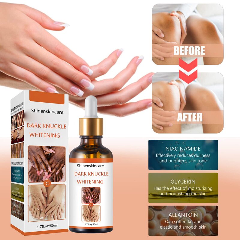 Hand Whitening Serum Supplier - OEM Private Label OEM ODM Hand