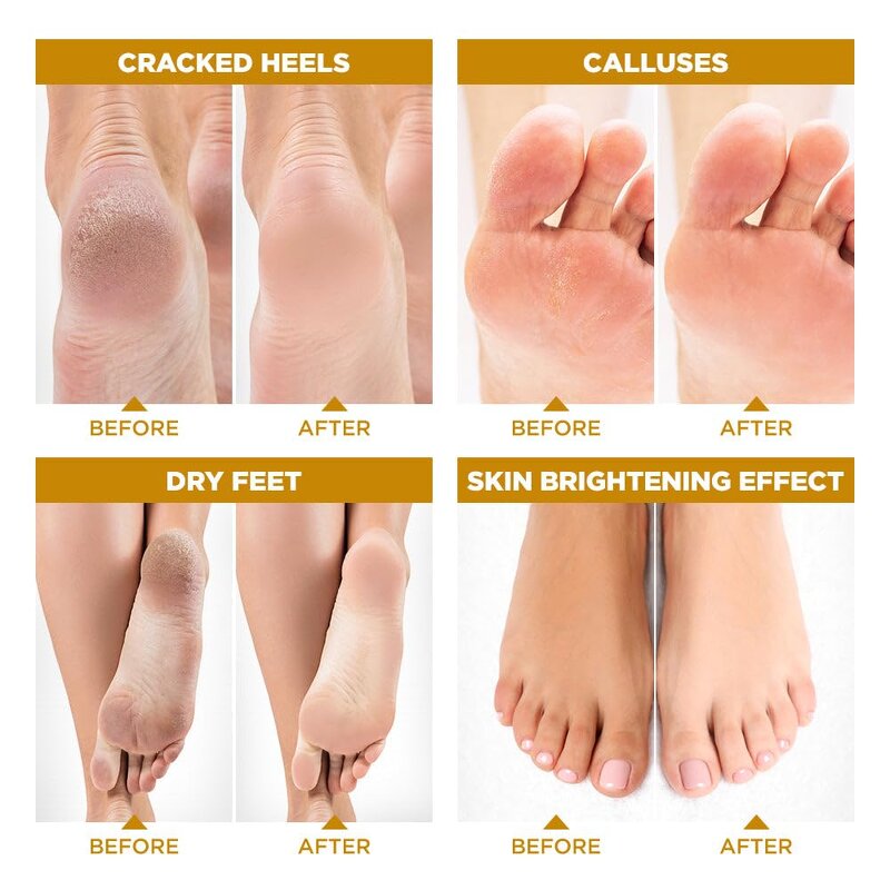 Foot Peeling Mask Supplier - OEM OEM ODM Natural Turmeric Kojic