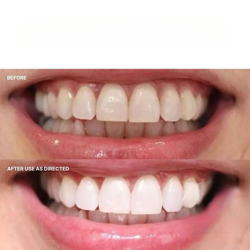 Whitening Toothpaste Factory - OEM Vanilla Mint Removes Stains