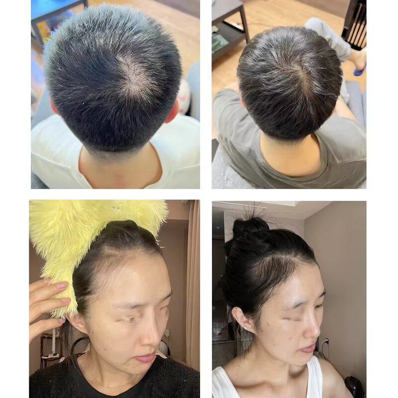 Hair Care Essence Supplier - Micro-molecular Biotin Repair Prevent Loss
