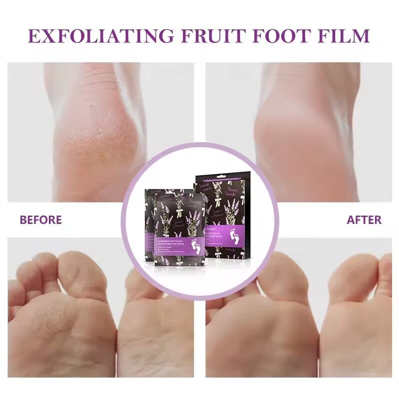 Foot Peel Mask Supplier - Custom Organic Lavender Exfoliating Baby Soft