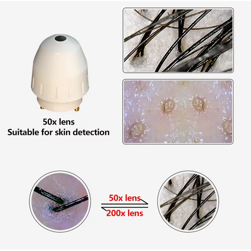 Scalp Analyzer Supplier - 2024 New OEM Dermatology Mobile UV Camera