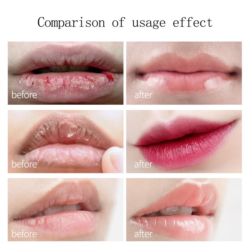 Lip Mask Factory - Natural Moisturizing Organic Collagen Sheet Wholesale