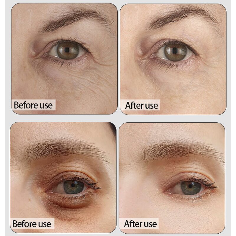 Eye Mask Manufacturer - Private Label Anti-wrinkle Moisturizing Dark Circles