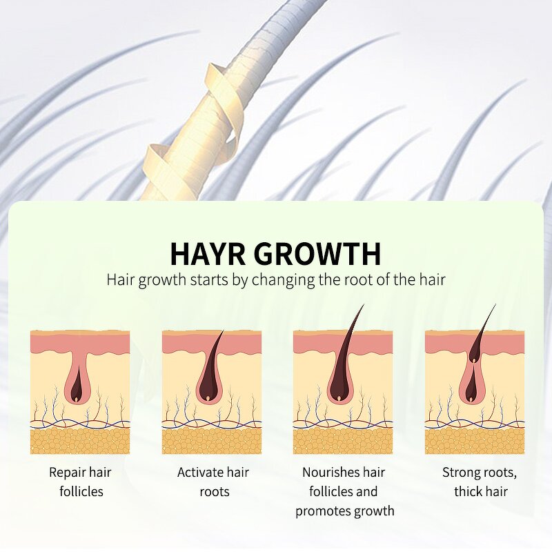 Hair Growth Oil Factory - Wholesale Best Selling Vitamins Rosemary Fast