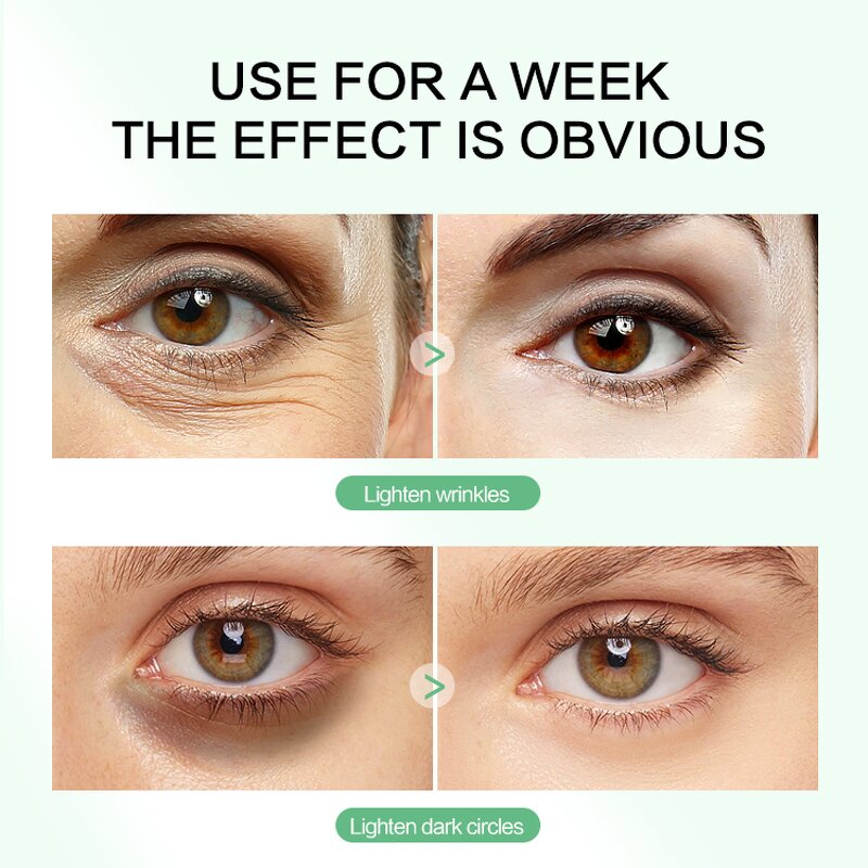 Under Eye Patch Manufacturer - Custom Private Label Collagen Hydrogel