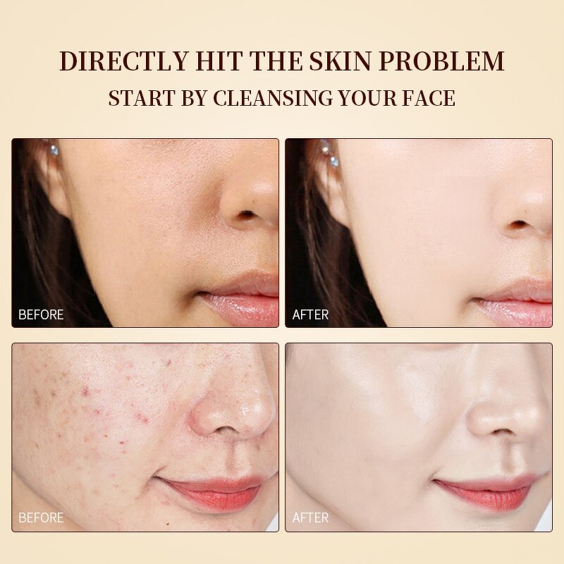 Face Wash Supplier - OEM Amino Acid Foaming Simple Cleanser Product