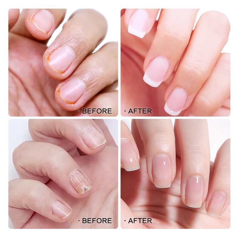 Cuticle Oil Pen Manufacturer - Private Label Korean Nail Care Repair Serum