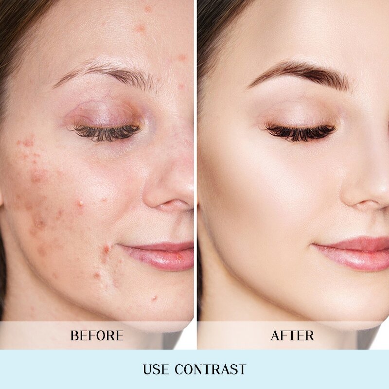 Face Toner Manufacturer - Private Label Brightening Hyaluronic Acid Essence