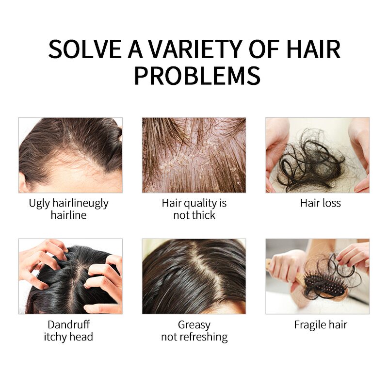 Hairloss Shampoo Supplier - 100% Organic Gentle Anti Itch Anti-dandruff