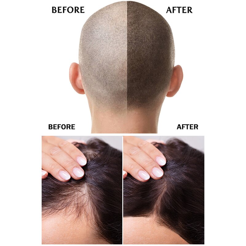 Shampoo Manufacturer - Free Sample OEM No Sulphate Turmeric Hotel Hair Care