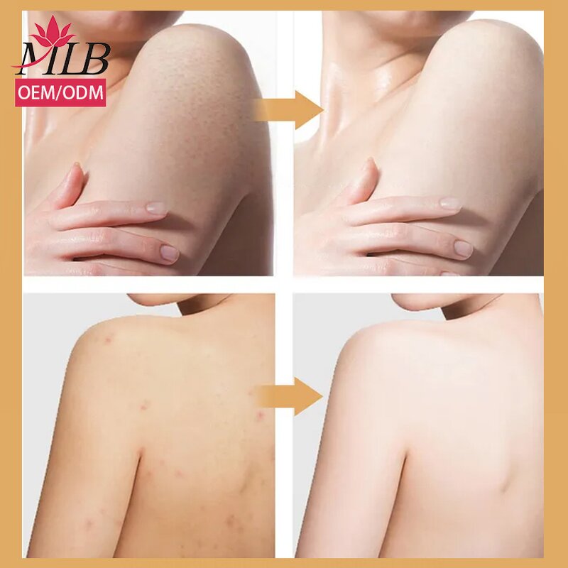 Coconut Skin Scrub Supplier - OEM Wholesale Custom logo Private Label