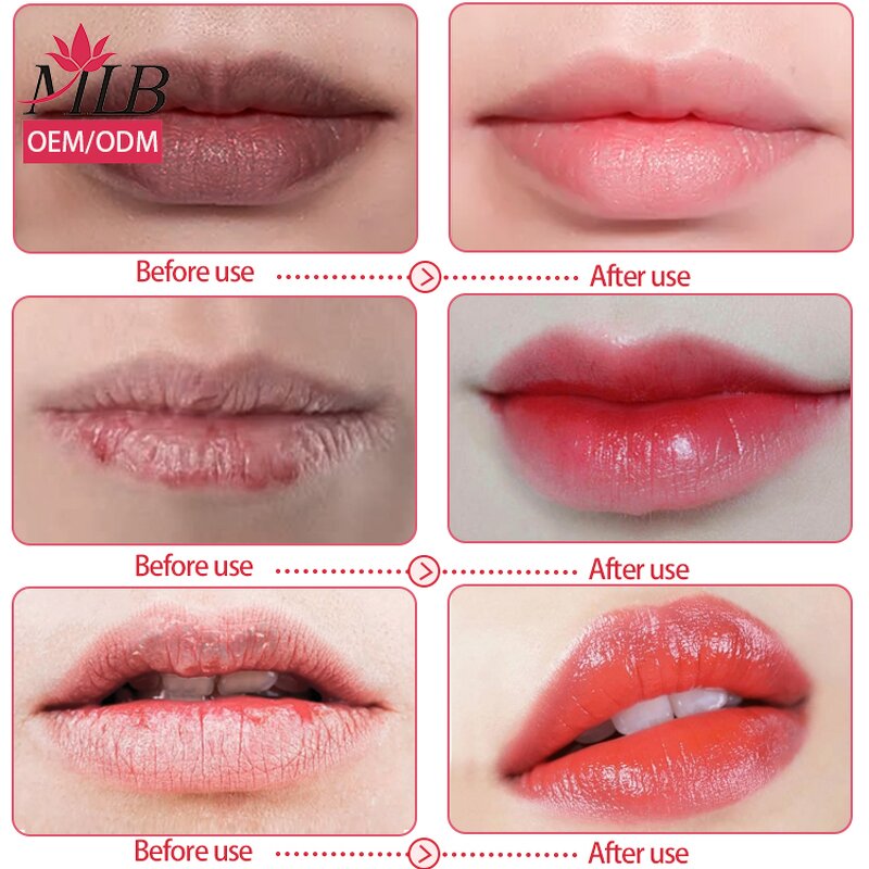 Crystal Lip Mask Supplier - OEM Private Label 24k Gold Collagen