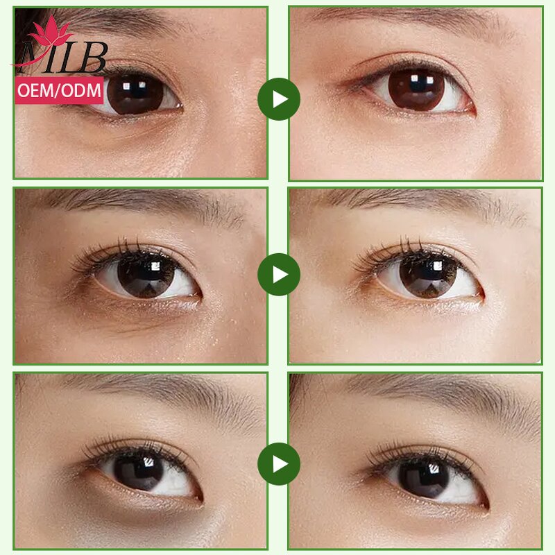 Cooling Crystal Eye Sheet Factory - OEM MLB New Arrival Private Label