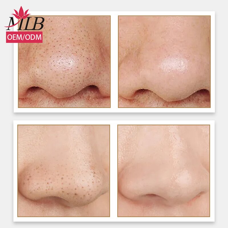 Nose Mask Manufacturer - OEM MLB Bamboo Activated Charcoal