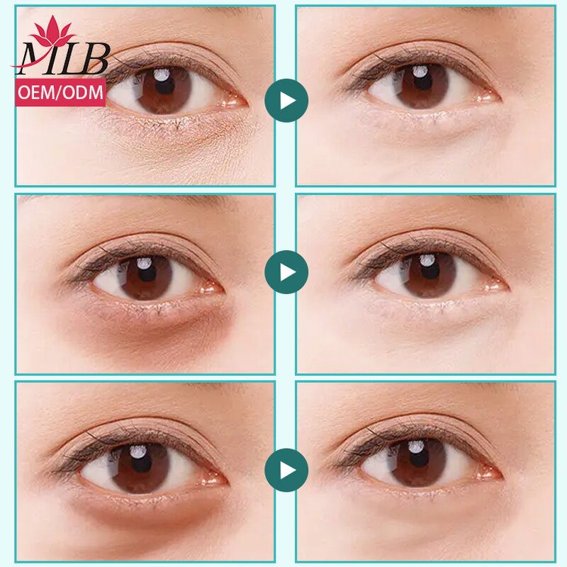 Crystal Collagen Eye Mask Supplier - OEM MLB Private Label Wholesale