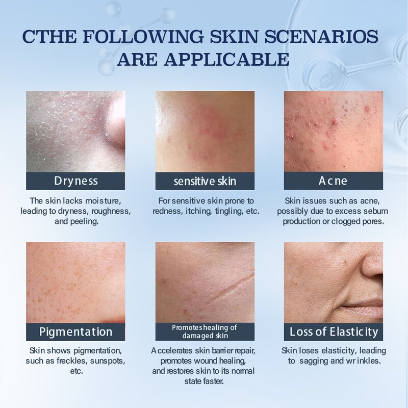 Acne Pore Minimizer Serum Supplier - OEM Beauty Products Skin Care Rapid