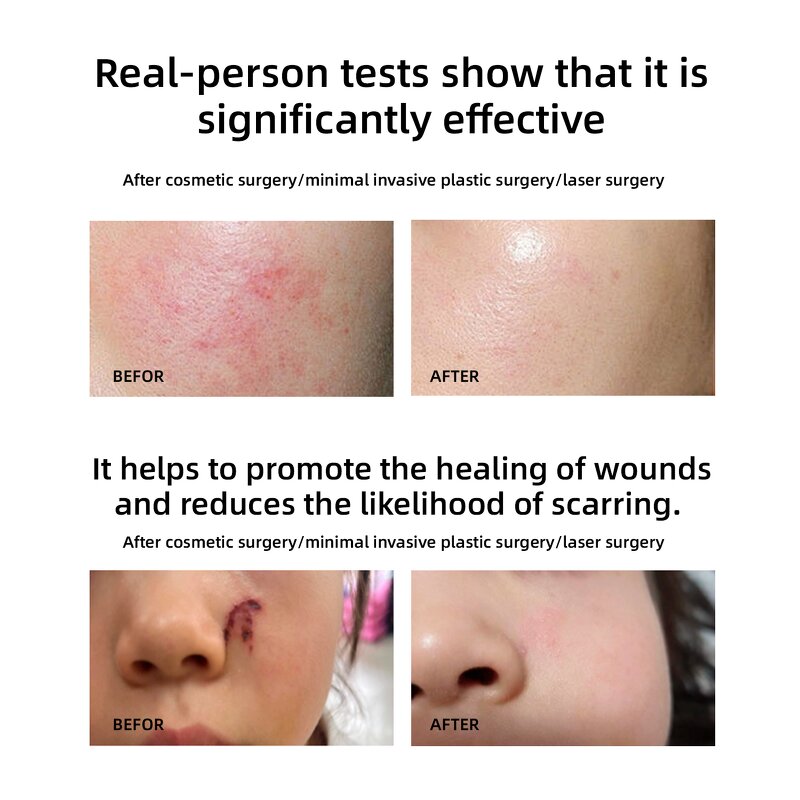 Vegan Anti Wrinkle Serum Manufacturer - OEM Private Label Nourishing Hyaluronic