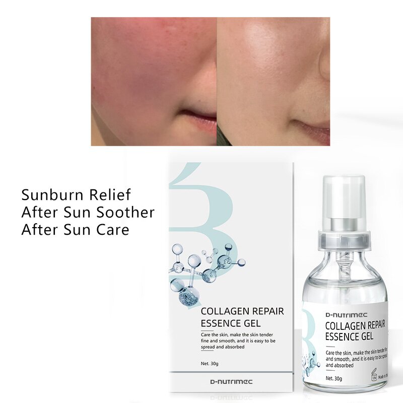 Sunburn Soothing Gel Supplier - OEM Whitening Repair Redness Sensitivity