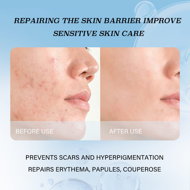 Transparent Bandage Cream Manufacturer - OEM Moisturizing Anti-aging Smearable