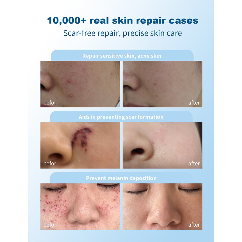 Acne Pore Minimizer Serum Supplier - OEM Beauty Products Skin Care Rapid