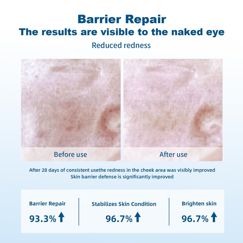 Vegan Face Toner Spray Factory - OEM Custom Logo Recombinant Collagen