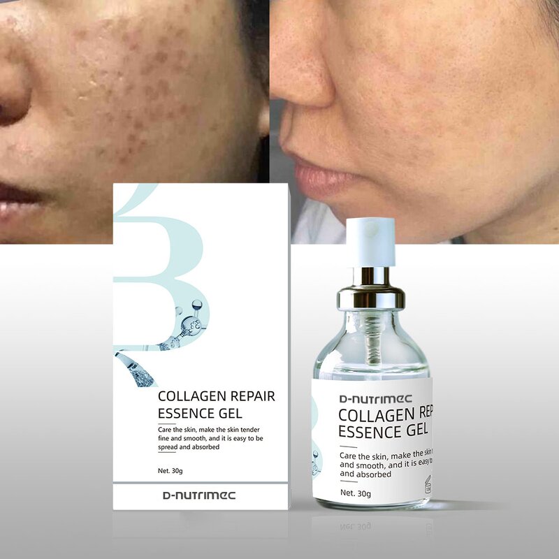 Hypoallergenic Collagen Serum Factory - OEM Private Label for Sensitive Acne