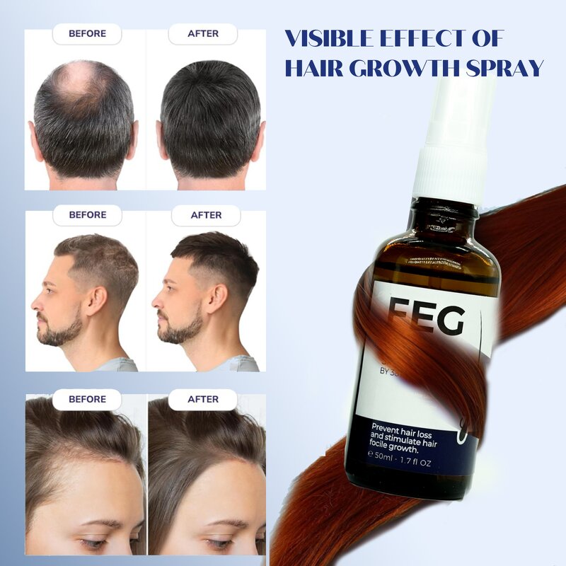 Hair Growth Serum Factory - Private Label Anti Loss Thicken Regrowth Spray