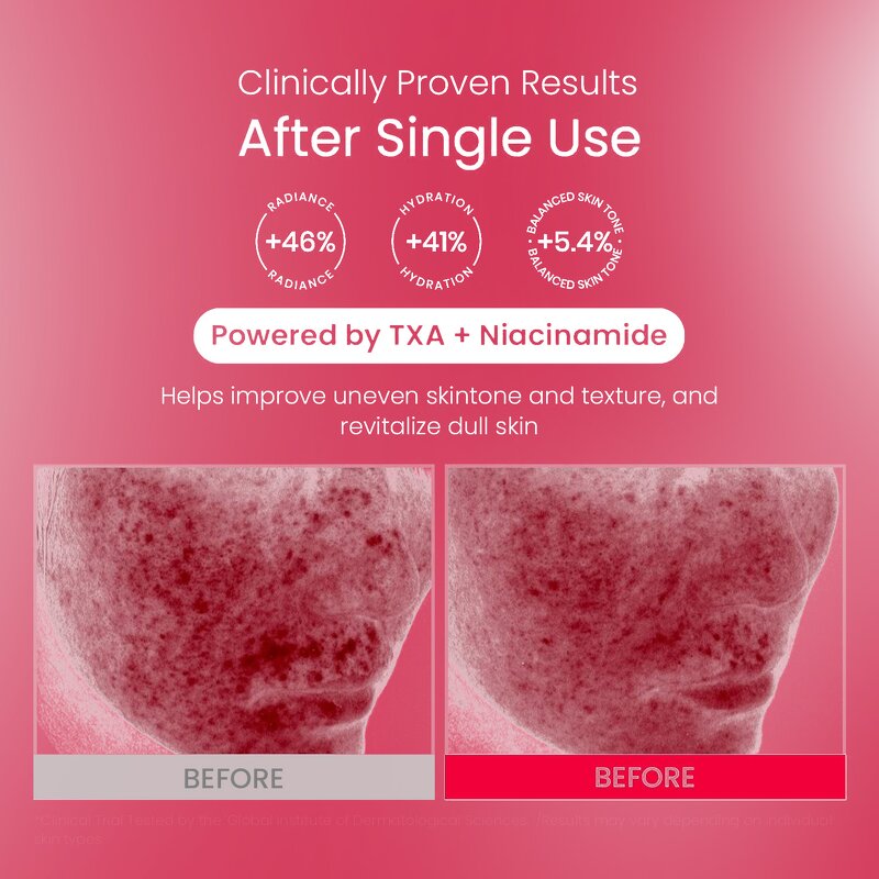 TXA Niacinamide Cream Supplier - OEM Moisturizer Tranexamic Acid Capsule