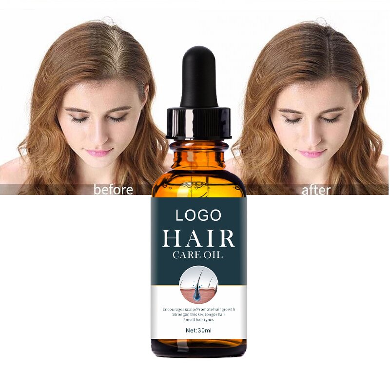 Hair Growth Oil Serum Factory - OEM Private Label OEM Natural Organic