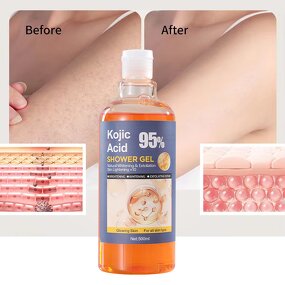 Kojic Acid Shower Gel Manufacturer - OEM Whitening Shower Gel With