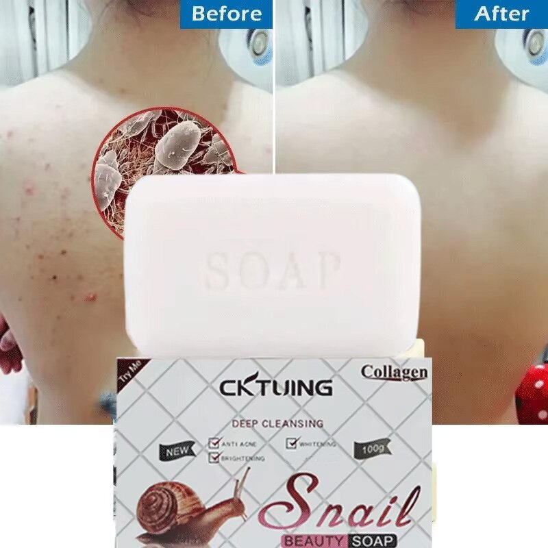 Snail Whitening Soap Factory - OEM Wholesale New Products Acne