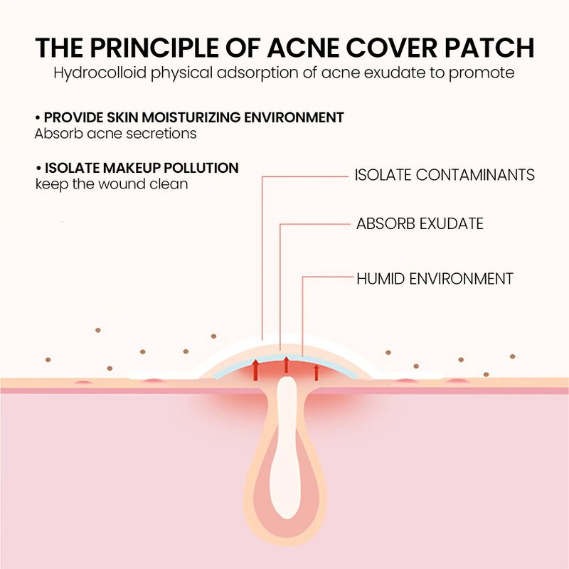 Hydrocolloid Acne Patch Factory - OEM Waterproof Custom Star Pimple