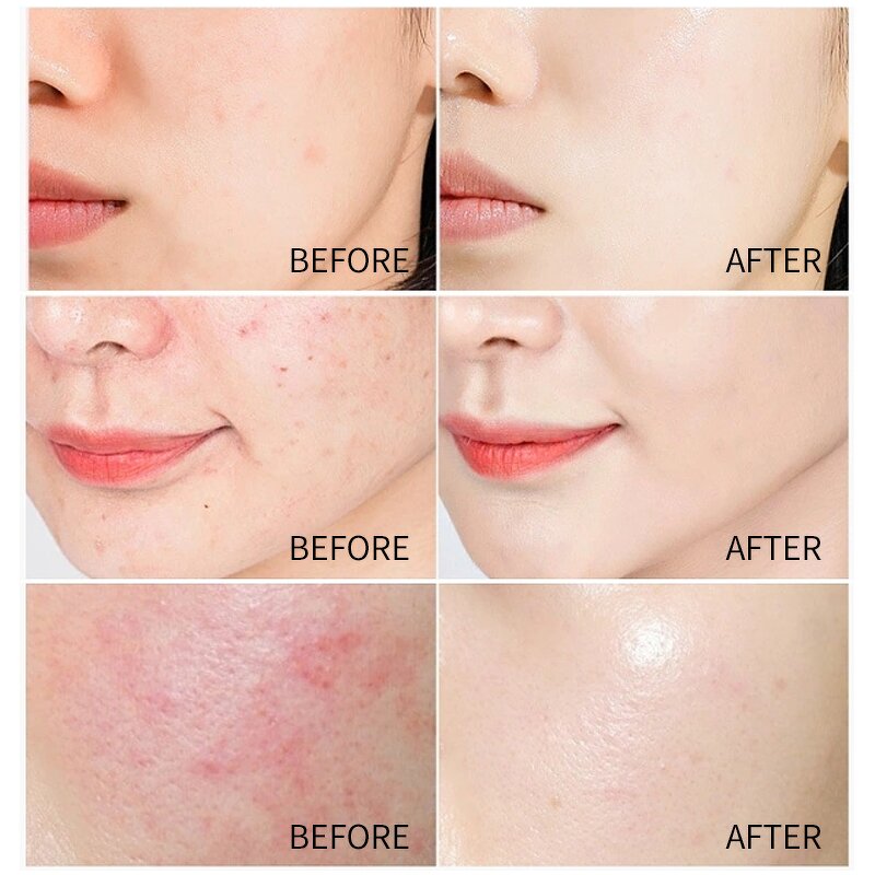 Rice Toner Manufacturer - OEM Private Label Natural Moisturizing