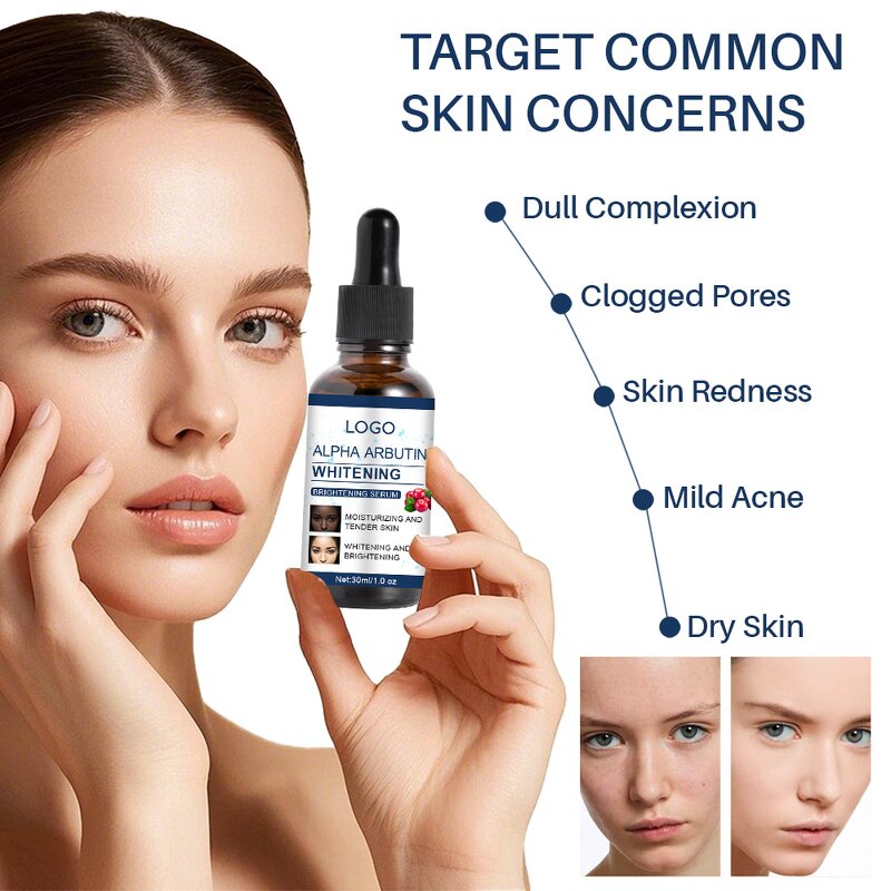 Alpha Arbutin Serum Manufacturer - OEM Private Label Natural Niacinamide