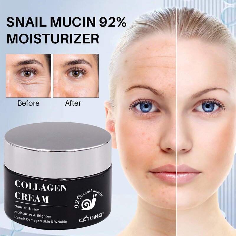 Snail Mucin Cream Factory - OEM Skin Care Products Lifting Remove