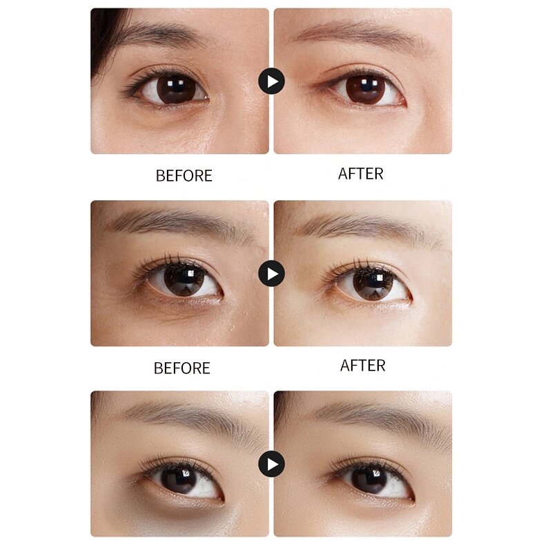 Hydrogel Eye Patches Manufacturer - OEM OEM Custom Skin Care Products