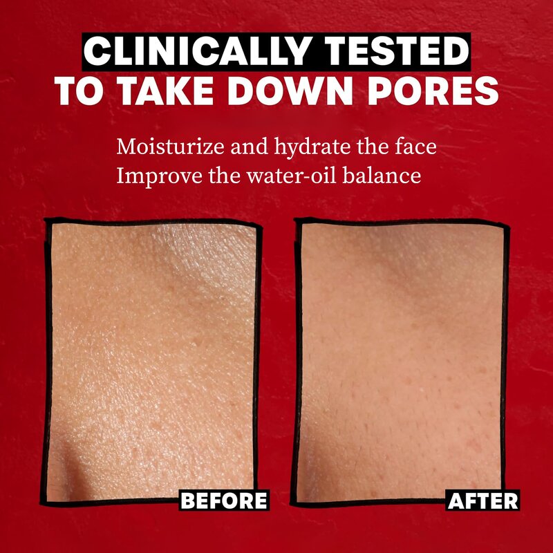 Vitamin C Ampoule Factory - OEM Brightening 1.5ml BFS Aseptic Hyaluronic Acid