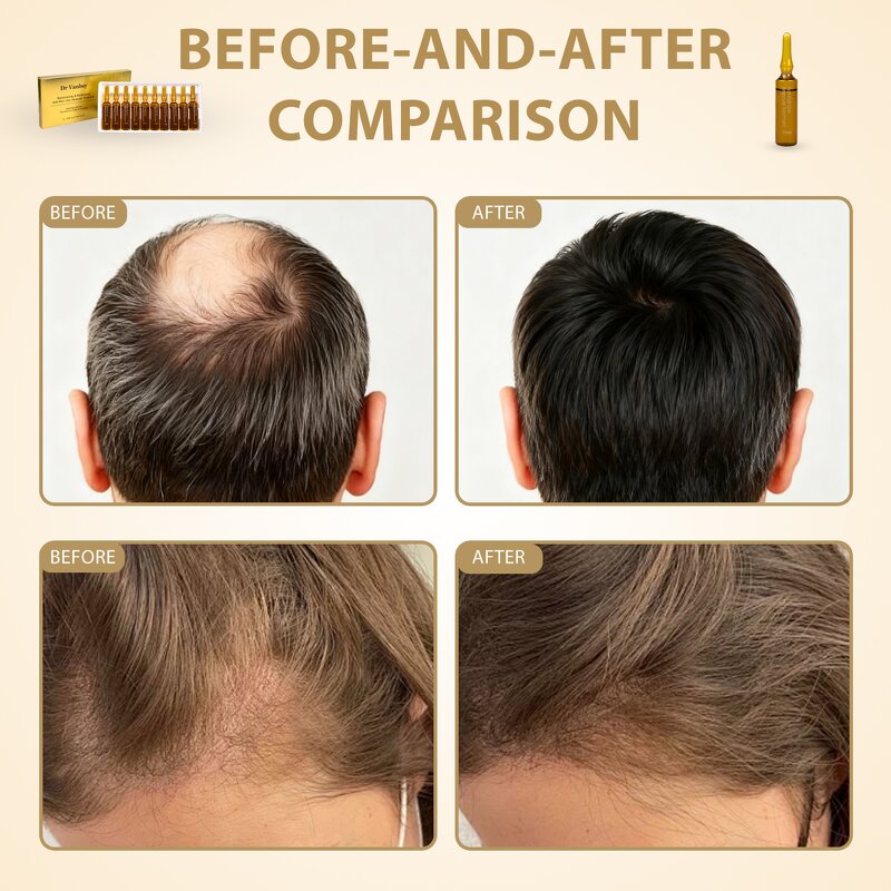 Hair Growth Serum Spray Manufacturer - OEM Wholesale Private Label Moisturizing Encourages