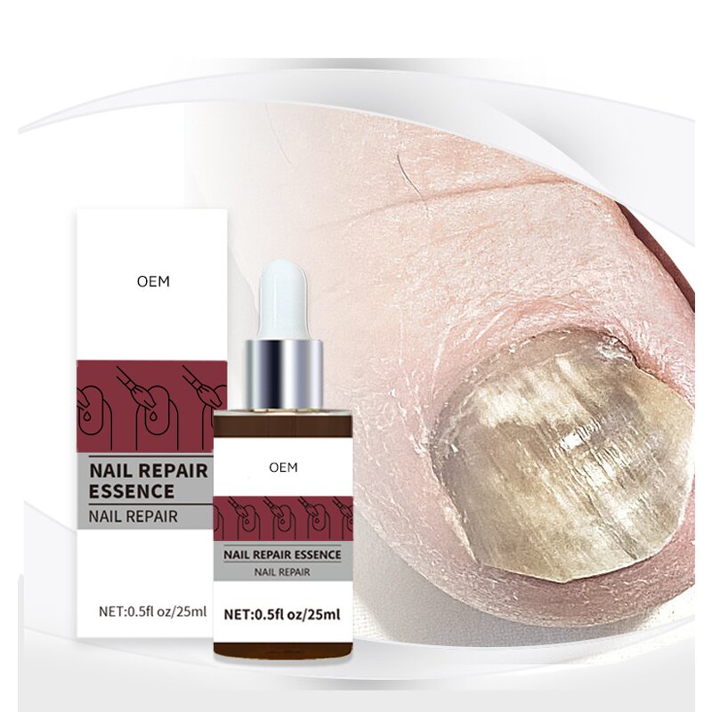Nail Repair Essence Factory - Wholesale Nail Care Product Effective Regeneration Strengthening