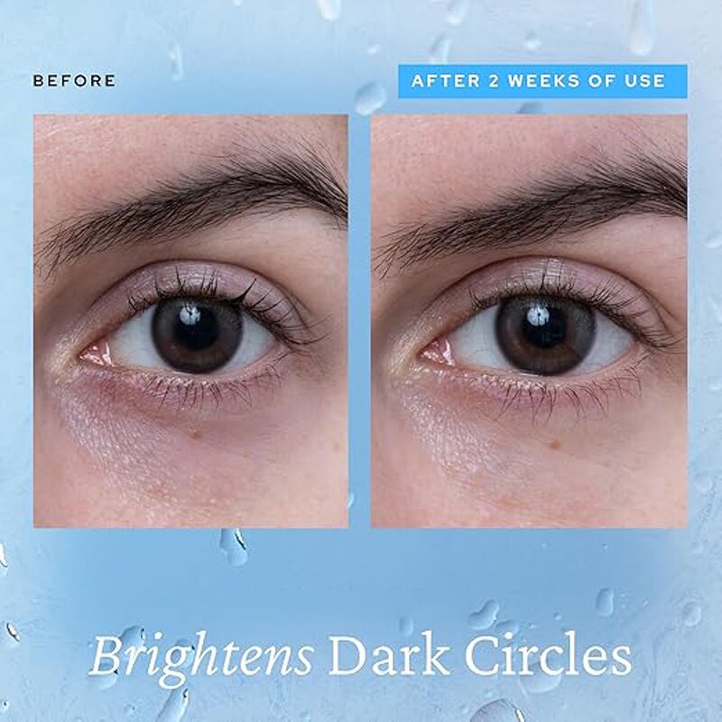 Eye Gel Factory - OEM/ODM Private Label Aqua Bomb Cooling Caffeine Hyaluronic Acid