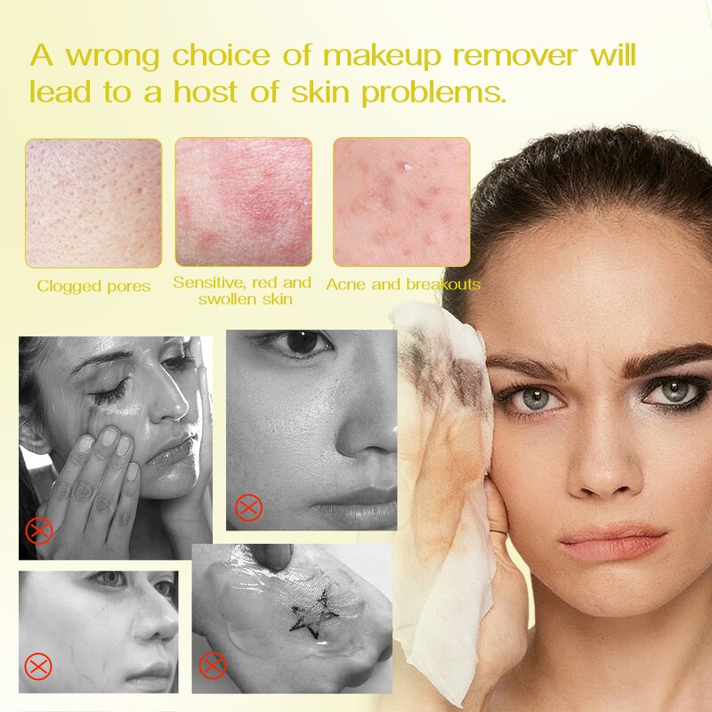 Micellar Water Manufacturer - OEM Gentle Cleansing All Skin Types Makeup Remover