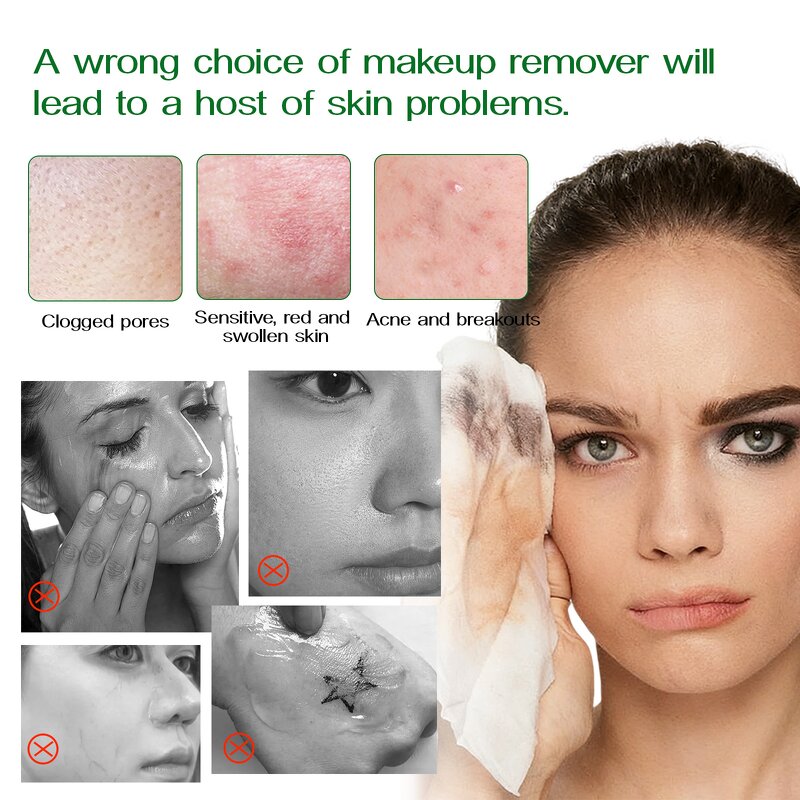 Micellar Water Manufacturer - OEM Aloe Vera Luxe Scents Makeup Remover