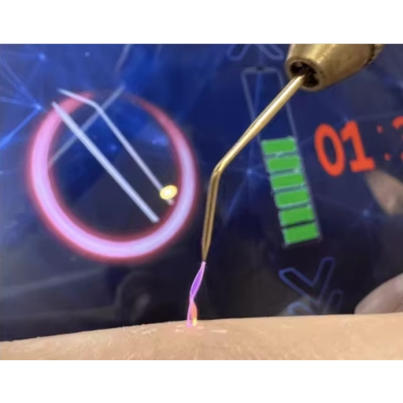 Plasma Machine Manufacturer - Spot Removal Skin Tightening Face Lift